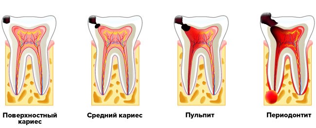 Современное лечение зубов - съемные зубные протезы, цена в Днепре