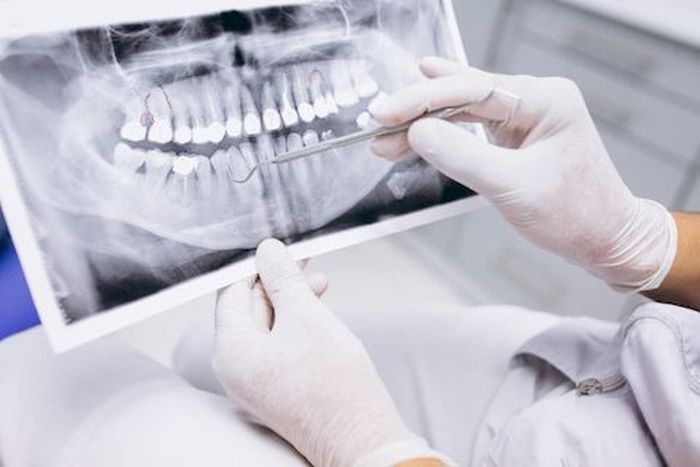 Диагностика зубов: в какую клинику лучше обратиться?