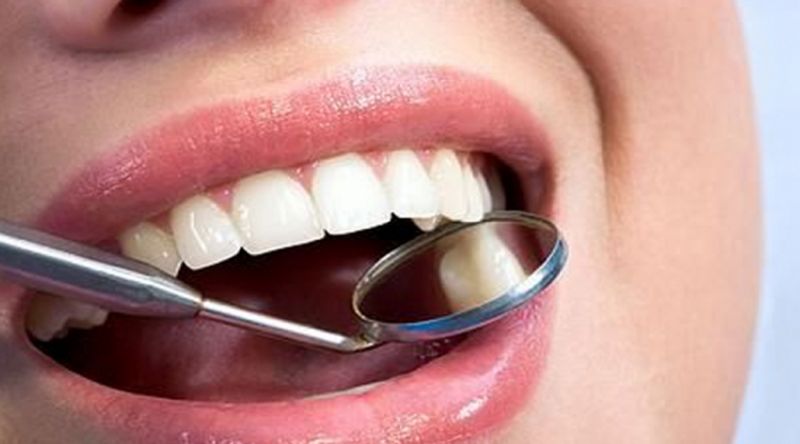 Лечение зубов: какую стоматологию стоит выбрать в Одессе